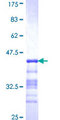 NR2C1 Protein - 12.5% SDS-PAGE Stained with Coomassie Blue.