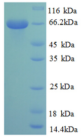 NR2C2 / TAK1 Protein