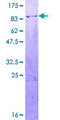 NR2C2 / TAK1 Protein - 12.5% SDS-PAGE of human NR2C2 stained with Coomassie Blue