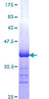 NR2C2 / TAK1 Protein - 12.5% SDS-PAGE Stained with Coomassie Blue.