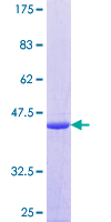 NR2C2AP / TRA16 Protein - 12.5% SDS-PAGE of human TRA16 stained with Coomassie Blue