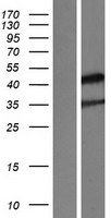 NR2E1 / TLX Protein - Western validation with an anti-DDK antibody * L: Control HEK293 lysate R: Over-expression lysate