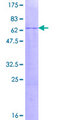 NR2E1 / TLX Protein - 12.5% SDS-PAGE of human NR2E1 stained with Coomassie Blue