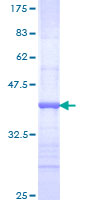 NR2E1 / TLX Protein - 12.5% SDS-PAGE Stained with Coomassie Blue.