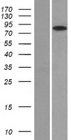 NR3C1/Glucocorticoid Receptor Protein - Western validation with an anti-DDK antibody * L: Control HEK293 lysate R: Over-expression lysate
