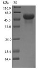 NR3C1/Glucocorticoid Receptor Protein - (Tris-Glycine gel) Discontinuous SDS-PAGE (reduced) with 5% enrichment gel and 15% separation gel.