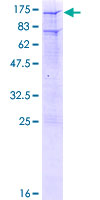 NR3C1/Glucocorticoid Receptor Protein - 12.5% SDS-PAGE of human NR3C1 stained with Coomassie Blue