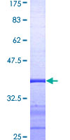 NR3C1/Glucocorticoid Receptor Protein - 12.5% SDS-PAGE Stained with Coomassie Blue.