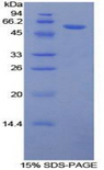 NR3C1/Glucocorticoid Receptor Protein - Recombinant Nuclear Receptor Subfamily 3, Group C, Member 1 By SDS-PAGE