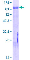 NR4A1 / NUR77 Protein - 12.5% SDS-PAGE of human NR4A1 stained with Coomassie Blue