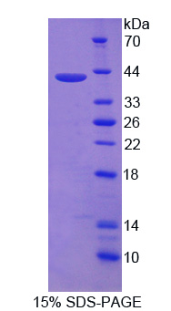 NR4A2 / NURR1 Protein - Recombinant Nuclear Receptor Related Protein 1 By SDS-PAGE