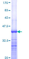 NR5A2 / LRH-1 Protein - 12.5% SDS-PAGE Stained with Coomassie Blue.