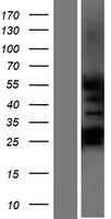 NR6A1 / GCNF Protein - Western validation with an anti-DDK antibody * L: Control HEK293 lysate R: Over-expression lysate
