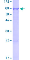 NR6A1 / GCNF Protein - 12.5% SDS-PAGE of human NR6A1 stained with Coomassie Blue