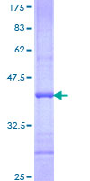 NR6A1 / GCNF Protein - 12.5% SDS-PAGE Stained with Coomassie Blue.