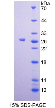 NR6A1 / GCNF Protein - Recombinant  Germ Cell Nuclear Factor By SDS-PAGE