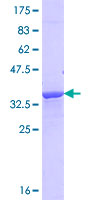 NRAP Protein - 12.5% SDS-PAGE Stained with Coomassie Blue.