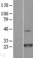 NRAS / N-ras Protein - Western validation with an anti-DDK antibody * L: Control HEK293 lysate R: Over-expression lysate