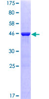 NRAS / N-ras Protein - 12.5% SDS-PAGE of human NRAS stained with Coomassie Blue