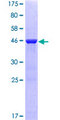 NRAS / N-ras Protein - 12.5% SDS-PAGE of human NRAS stained with Coomassie Blue