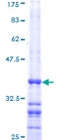 NRAS / N-ras Protein - 12.5% SDS-PAGE Stained with Coomassie Blue.