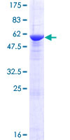 NRBP2 Protein - 12.5% SDS-PAGE of human NRBP2 stained with Coomassie Blue