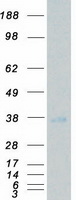 NRBP2 Protein - Purified recombinant protein NRBP2 was analyzed by SDS-PAGE gel and Coomassie Blue Staining