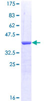 NRCAM Protein - 12.5% SDS-PAGE Stained with Coomassie Blue.