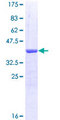 NRCAM Protein - 12.5% SDS-PAGE Stained with Coomassie Blue.