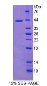 NRCAM Protein - Recombinant Neuronal Cell Adhesion Molecule (NRCAM) by SDS-PAGE