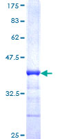 NRD1 / Nardilysin Protein - 12.5% SDS-PAGE Stained with Coomassie Blue.
