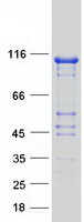 NRDE2 / C14orf102 Protein - Purified recombinant protein C14orf102 was analyzed by SDS-PAGE gel and Coomassie Blue Staining