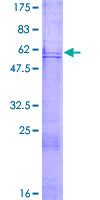 NRG1 / Heregulin / Neuregulin Protein - 12.5% SDS-PAGE of human NRG1 stained with Coomassie Blue