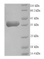 NRG2 Protein - (Tris-Glycine gel) Discontinuous SDS-PAGE (reduced) with 5% enrichment gel and 15% separation gel.