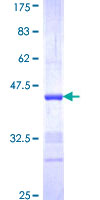 NRG2 Protein - 12.5% SDS-PAGE Stained with Coomassie Blue.