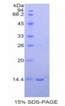 NRG2 Protein - Recombinant Neuregulin 2 By SDS-PAGE