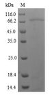 NRG3 Protein - (Tris-Glycine gel) Discontinuous SDS-PAGE (reduced) with 5% enrichment gel and 15% separation gel.