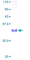 NRG4 Protein - 12.5% SDS-PAGE of human NRG4 stained with Coomassie Blue