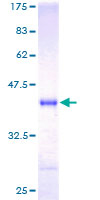 NRGN / Neurogranin Protein - 12.5% SDS-PAGE of human NRGN stained with Coomassie Blue