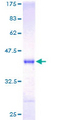 NRGN / Neurogranin Protein - 12.5% SDS-PAGE of human NRGN stained with Coomassie Blue