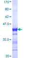 NRIP1 / RIP140 Protein - 12.5% SDS-PAGE Stained with Coomassie Blue.