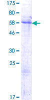 NRIP2 Protein - 12.5% SDS-PAGE of human NRIP2 stained with Coomassie Blue