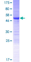 NRIP3 Protein - 12.5% SDS-PAGE of human NRIP3 stained with Coomassie Blue