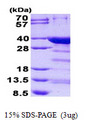NRIP3 Protein