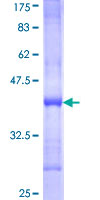 NRK Protein - 12.5% SDS-PAGE Stained with Coomassie Blue.