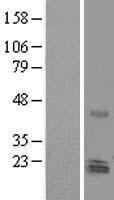 NRM Protein - Western validation with an anti-DDK antibody * L: Control HEK293 lysate R: Over-expression lysate