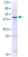 NRM Protein - 12.5% SDS-PAGE of human NRM stained with Coomassie Blue