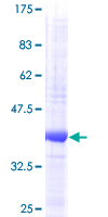 NRN1 / Neuritin Protein - 12.5% SDS-PAGE of human NRN1 stained with Coomassie Blue