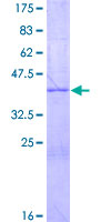 NRN1L Protein - 12.5% SDS-PAGE of human UNQ2446 stained with Coomassie Blue