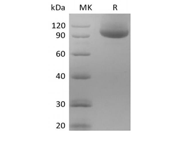 NRP1 / Neuropilin 1 Protein - Recombinant Human Neuropilin-1/NRP1 (C-Avi-6His) Biotinylated